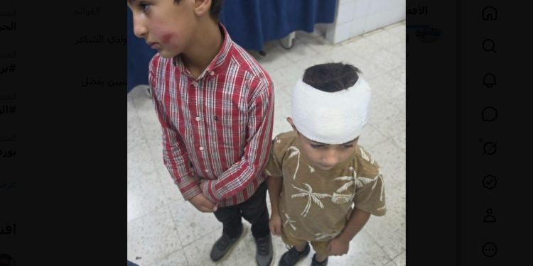 Two Palestinian Children Injured in West Bank Settler Stone-Throwing Attack
