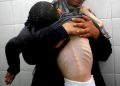 Al-Shifa Director: Gaza’s Miscarriage Rates Surge to 60–70%